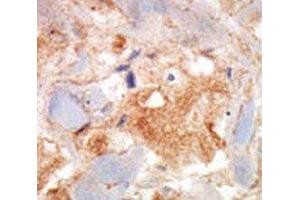 Image no. 1 for anti-Mast/stem Cell Growth Factor Receptor (KIT) (AA 9-40) antibody (ABIN3028571)