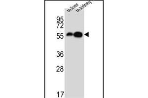 DDC Antikörper  (N-Term)