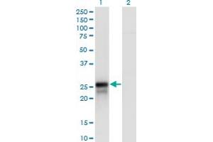 Image no. 1 for anti-DIRAS Family, GTP-Binding RAS-Like 2 (DIRAS2) (AA 81-180) antibody (ABIN565772)