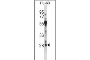 Image no. 1 for anti-Regulatory Factor X-Associated Protein (RFXAP) (AA 196-225), (C-Term) antibody (ABIN5534663)