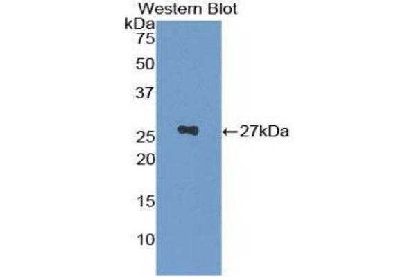 GSTP1 Antikörper  (AA 1-210)