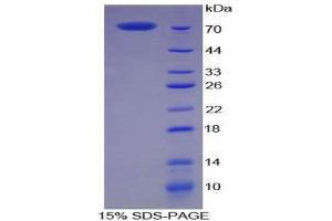 Image no. 1 for Creatine Kinase, Muscle (CKM) (AA 11-367) protein (His tag,GST tag) (ABIN1878928)
