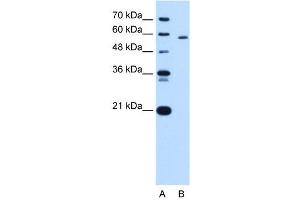 Image no. 3 for anti-Pyruvate Kinase, Liver and RBC (PKLR) (N-Term) antibody (ABIN629803)
