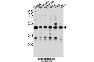 Image no. 1 for anti-Dihydrouridine Synthase 1-Like (DUS1L) (AA 321-349), (C-Term) antibody (ABIN656451)