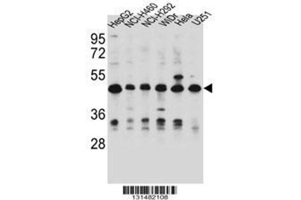 anti-Dihydrouridine Synthase 1-Like (DUS1L) (AA 321-349), (C-Term) antibody