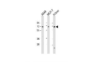 Image no. 5 for anti-Hyaluronan Binding Protein 2 (HABP2) (AA 378-408), (C-Term) antibody (ABIN651853)