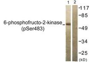 Western blot analysis of extracts from 293 cells treated with Heat shock, using PFKFB2 (Phospho-Ser483) Antibody.