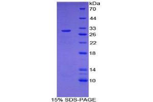 NUP107 Protein