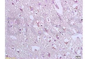 Formalin-fixed and paraffin embedded:  rat brain tissue labeled with Anti-Bax Polyclonal Antibody, unconjugated  (ABIN725390)  at 1: 800 followed by incubation with conjugated secondary antibody and DAB staining