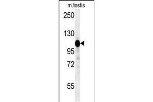 DACT1 Antikörper  (N-Term)