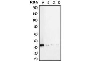 Image no. 3 for anti-Transforming Growth Factor, beta 1 (TGFB1) (C-Term) antibody (ABIN2705288)