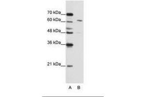Image no. 2 for anti-Cleavage and Polyadenylation Specific Factor 6, 68kDa (CPSF6) (AA 261-310) antibody (ABIN202751)