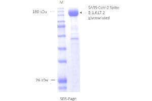 SARS-CoV-2 Spike Protein (B.1.617.2 - delta) (rho-1D4 tag)