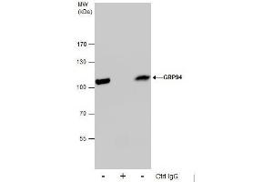 Image no. 4 for anti-Heat Shock Protein 90kDa beta (Grp94), Member 1 (HSP90B1) (Center) antibody (ABIN2855578)