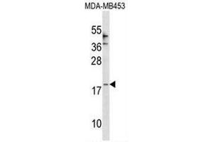 Image no. 1 for anti-Chemokine (C-C Motif) Ligand 25 (CCL25) (AA 65-95), (Middle Region) antibody (ABIN955137)