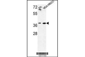Image no. 1 for anti-Methionine Adenosyltransferase II, beta (MAT2B) antibody (ABIN2445427)