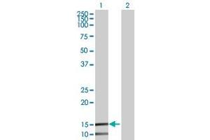Image no. 1 for anti-Interferon Induced Transmembrane Protein 2 (IFITM2) (AA 1-132) antibody (ABIN1327604)