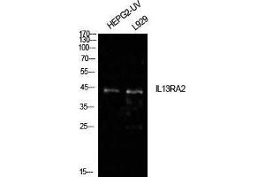 Image no. 3 for anti-Interleukin 13 Receptor, alpha 2 (IL13RA2) (Internal Region) antibody (ABIN3181455)