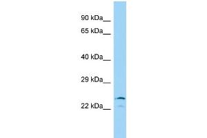 anti-Iodotyrosine Deiodinase (IYD) (N-Term) antibody