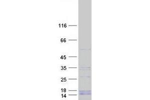 Image no. 1 for Exoribonuclease 1 (ERI1) protein (Myc-DYKDDDDK Tag) (ABIN2720477)