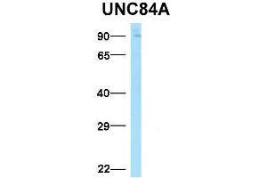Image no. 5 for anti-Sad1 and UNC84 Domain Containing 1 (SUN1) (N-Term) antibody (ABIN2783971)