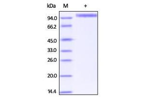 Biotinylated Human Her2, Superior Sensitivity on SDS-PAGE under reducing (R) condition.