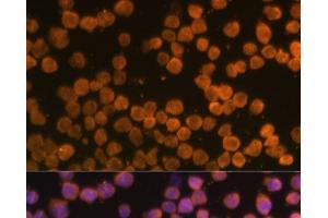 Immunofluorescence analysis of THP-1 cells using TNFRSF10A Polyclonal Antibody at dilution of 1:100 (40x lens).