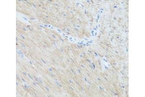 Immunohistochemistry of paraffin-embedded Mouse heart using CLUH Polyclonal Antibody at dilution of 1:100 (40x lens).