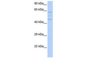 Image no. 1 for anti-Vacuolar Protein Sorting 37 Homolog A (VPS37A) (N-Term) antibody (ABIN6741204)
