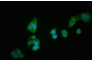 Image no. 1 for anti-Dipeptidyl-Peptidase 4 (DPP4) (AA 473-588) antibody (ABIN6953148)