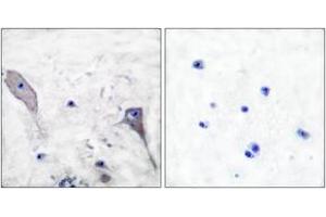 Image no. 2 for anti-Patched 1 (PTCH1) (AA 1-50) antibody (ABIN1533374)