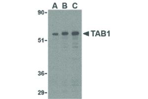 anti-TGF-beta Activated Kinase 1/MAP3K7 Binding Protein 1 (TAB1) (Internal Region) antibody