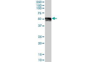 Image no. 2 for anti-Immunoglobulin Heavy Constant gamma 1 (G1m Marker) (IGHG1) (AA 1-469) antibody (ABIN1327632)