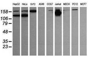 Image no. 5 for anti-Phosphoinositide-3-Kinase, Catalytic, gamma Polypeptide (PIK3CG) antibody (ABIN1500202)