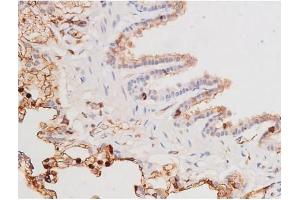 Image no. 6 for anti-Mast/stem Cell Growth Factor Receptor (KIT) (pTyr703) antibody (ABIN6255994)