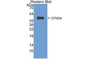 Image no. 1 for anti-Eukaryotic Translation Initiation Factor 2-alpha Kinase 2 (EIF2AK2) (AA 205-495) antibody (ABIN2117704)
