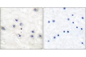 Image no. 2 for anti-Mitogen-Activated Protein Kinase Kinase Kinase 8 (MAP3K8) (AA 256-305) antibody (ABIN2888594)
