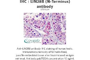 Image no. 1 for anti-Lin-28 Homolog B (LIN28B) (N-Term) antibody (ABIN2852407)