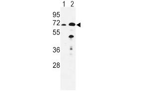 Image no. 3 for anti-Enoyl-CoA, Hydratase/3-Hydroxyacyl CoA Dehydrogenase (EHHADH) antibody (ABIN3003844)