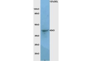 Image no. 4 for anti-Lysosomal-Associated Membrane Protein 1 (LAMP1) (AA 301-417) antibody (ABIN676088)