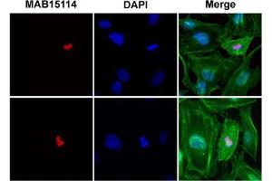 Image no. 2 for anti-Histone Cluster 1, H2bb (HIST1H2BB) (pSer14) antibody (ABIN5579892)