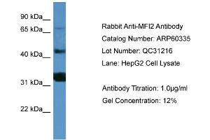 Image no. 3 for anti-Antigen P97 (Melanoma Associated) Identified By Monoclonal Antibodies 133.2 and 96.5 (MFI2) (C-Term) antibody (ABIN2774284)