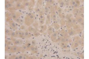 Image no. 4 for anti-Microseminoprotein, beta (MSMB) (AA 19-114) antibody (ABIN1175773)