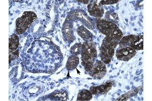GC-Rich Promoter Binding Protein 1 (GPBP1) (N-Term) antibody