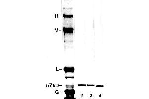 Image no. 1 for anti-Peripherin (PRPH) antibody (ABIN1580457)