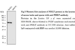 PDILT antibody  (C-Term)