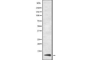 Image no. 1 for anti-Ubiquitin Related Modifier 1 (Urm1) (Internal Region) antibody (ABIN6265904)