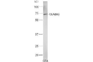 Image no. 3 for anti-Carcinoembryonic Antigen Gene Family (CEA) antibody (ABIN722946)