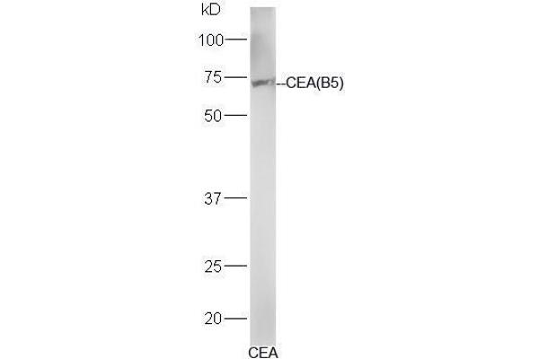 CEA antibody