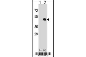 Image no. 2 for anti-HLA Class I Histocompatibility Antigen, alpha Chain E (HLA-E) (AA 108-135) antibody (ABIN652456)